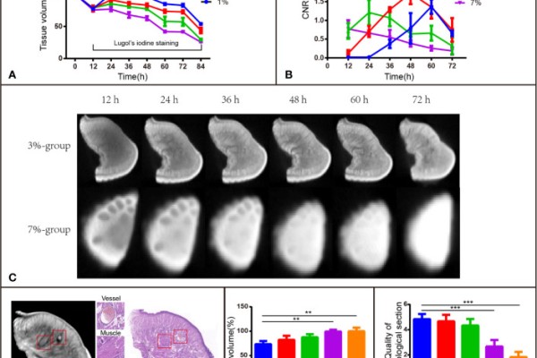 Lugol's Iodine-enhanced micro-CT: a potential 3-D imaging method for detecting tongue squamous cell carcinoma specimens in surgery